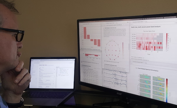 Accelerate your research